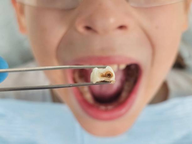 Best Emergency Dentist for Special Needs Patients in Halls, TN
