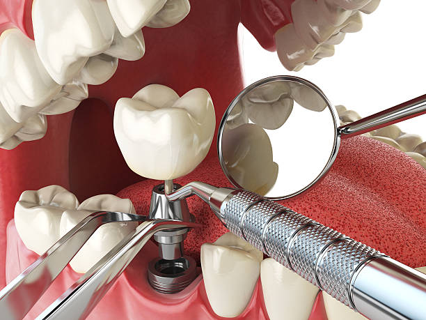 Best Weekend Emergency Dentist in Halls, TN